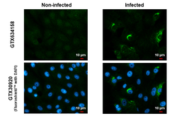 Anti-Zika virus NS1 protein antibody [GT5212] used in Immunocytochemistry/ Immunofluorescence (ICC/IF). GTX634158